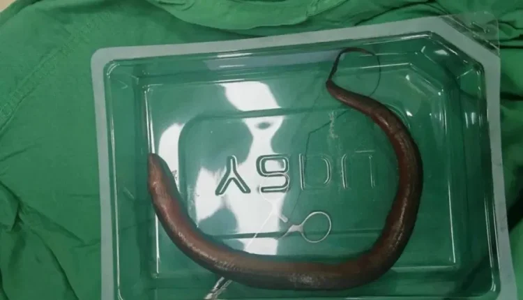 الثعبان بعد استخراجه.